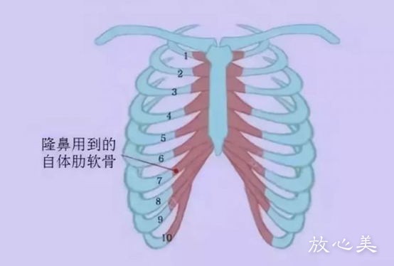 天津市人民医院烧伤整形外科费用表2021版预览，隆鼻案例！