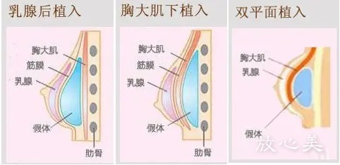 沭阳中医院医学美容中心是公立医院吗?口碑_费用表_胸部整形案例_优势分析