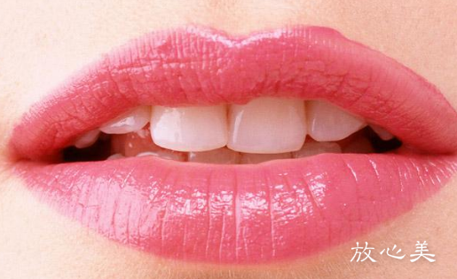 上海第九人民医院唇矫正附收费价目表一览！