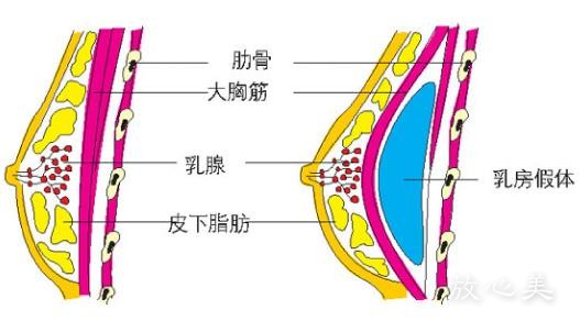 北京市第六医院整形美容外科隆胸需要多少钱?医生技术水平|案例分享